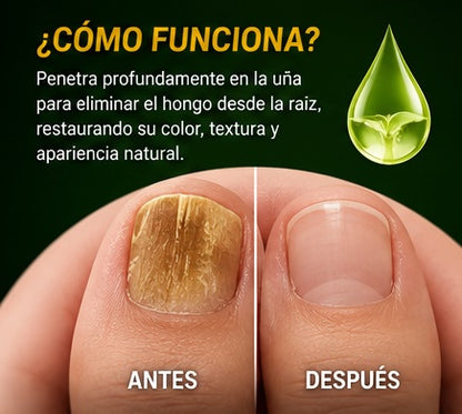 7 DAYS - HONGO UÑAS