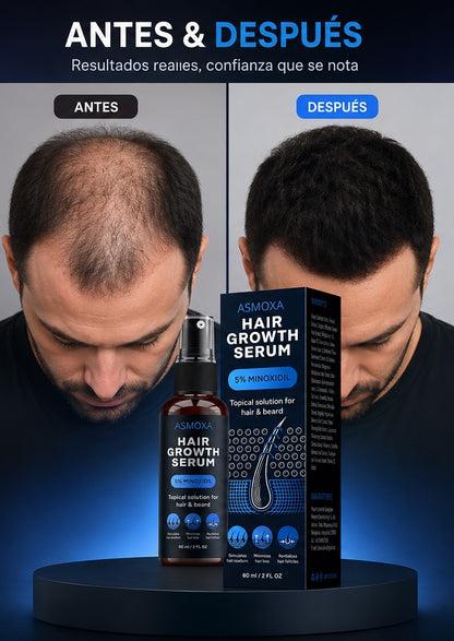 SUERO PARA EL CRECIMIENTO DEL CABELLO, 5% MINOXIDIL Y BIOTINA PARA HOMBRES Y MUJERES, TIENE LA PÉRDIDA DE CABELLO
